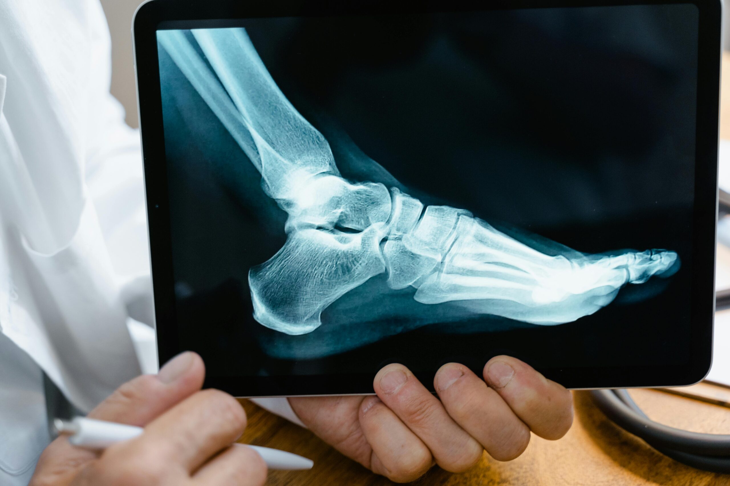 X-ray image showing a fractured bone, symbolizing the seriousness of personal injury cases in the Texas Hill Country